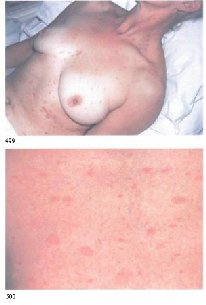 �o�e�x�oc�� �������� �������� �� ������ omentum