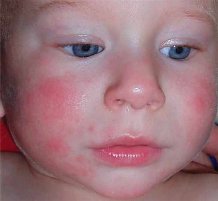 ��a�e��� ����������� ���� �� ����� ���� ������������