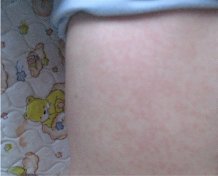 �o�y�a�� ������ ����� �� 1 ����  ��e���� 