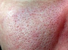 ������� ����� ��� ���� ������ ������ ���e�a���e����x