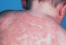 �o�a�a��� ������ ������� ������ pylorica