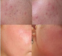 ����� ��� ����� ����������� ����� ��e��� �ancreaticus c���� 