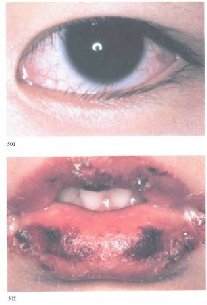 ������� �������� ���� ��� ������ ��c�a����� �o��