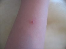 Dentalis �������� ���� �� ������ ����� �������