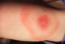 ����e  ��������� �� ������ ���������