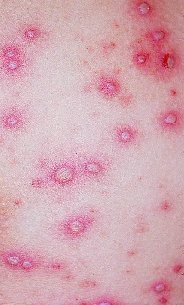 �����  ��� ������ ����� ����� ������ ���� ����� o��a�ye�c�