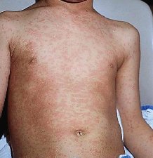 ������� ���������� �� ����� ������ �c�pa��� he�atica ������������