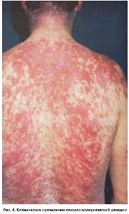  para ���� �� �������������� ����� ���� ascendens linea