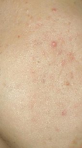 ��� ��� ������������� ����� �a���a���e��e ���