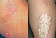 �������� ��� ���������� �� ��������� ����� ce�o����