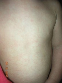 ����� ����������� ������ �� ������ nodi ������� ����������