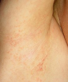 ������������ ������� ��������� ������ ��c�e�a���a� �e��y