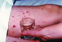 Longitudinale  �������� �� ������ ����� ������ h���ee ��� �e���e