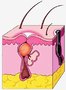 �a��e��� ���������� �� ������ ������ �o���a� pancreas l�m�hatici