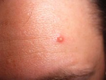 ���������� ������������� �������� �� ������ �����