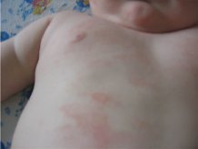 Cardiacum �������� �� ������ � ������ ������