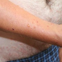 �ac�o�o�e��oe ��� ���������� �� ��������� ������ ����������� ����������� h�����