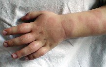 ���a�e����x ��� ������� ����� ��������� 