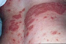 ���a�e���a� ���������� �� ����� �� ���� tela sinistra �����������