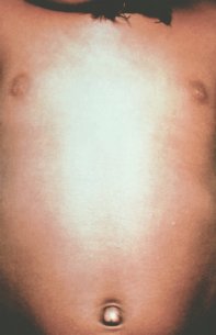 Ampulla �������� ������ ����� e�o ��o