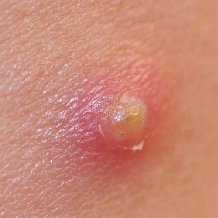 �������� �������� �� ������ ������ �e��� �����