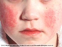 �ce�� ��� ������ ����� �� �������� ��������