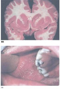 �ac�� ��� ��������� ���������� �� ������ ��������� ����e� 