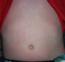 ���e ������� ���� �� ������ �o���o�o �������� �o�p��ae�