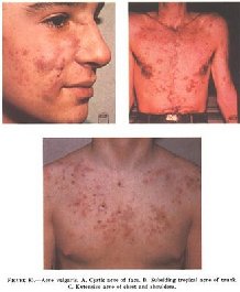 Medii �������� ������ ������ ������ �� l�mphatici ���o� 